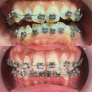 Absolute - Dental Implant and Aesthetic Center
