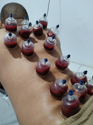 klinik Bekam dan Herbal Slipi
