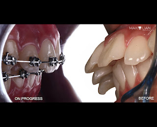 Maximilian Dental Center